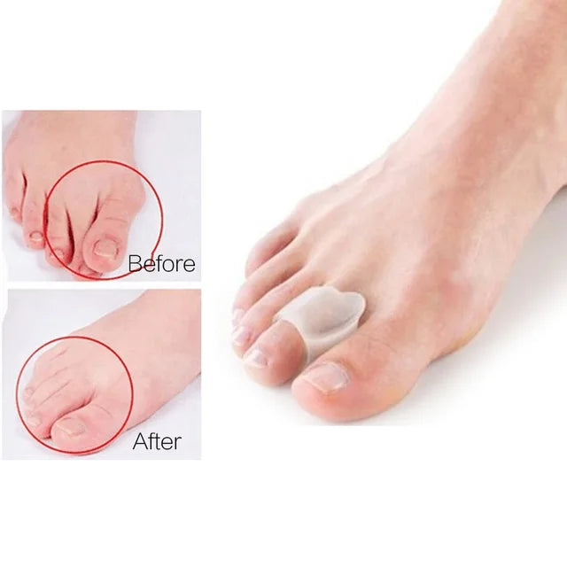 2Pcs=1Pair Silicone Toes Separator Bunion Bone Ectropion Adjuster Toes Outer Appliance Foot Care Tools Hallux Valgus Corrector