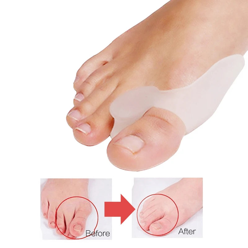 2Pcs=1Pair Silicone Toes Separator Bunion Bone Ectropion Adjuster Toes Outer Appliance Foot Care Tools Hallux Valgus Corrector